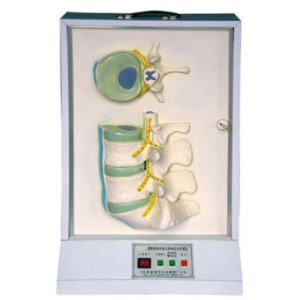 Lumbosacral vertebra, intervertebral disc and spinal nerve electric model